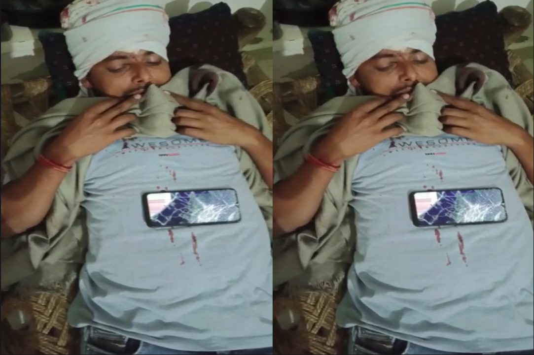 Morena Assembly Election 2023: वोट देने जा रहे युवक पर हमला, भाजपा के लोगों पर ताबड़तोड़ फायरिंग करने का आरोप