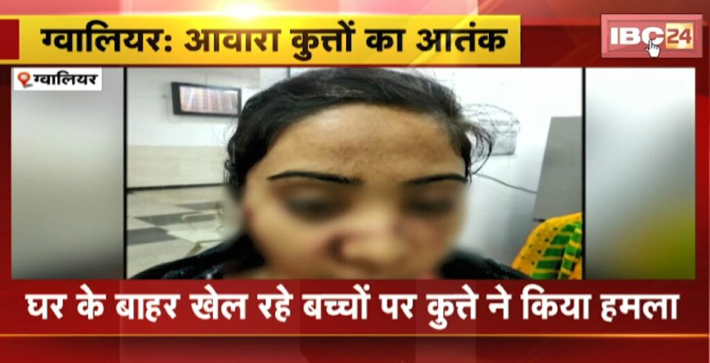 Gwalior Dog Attack News