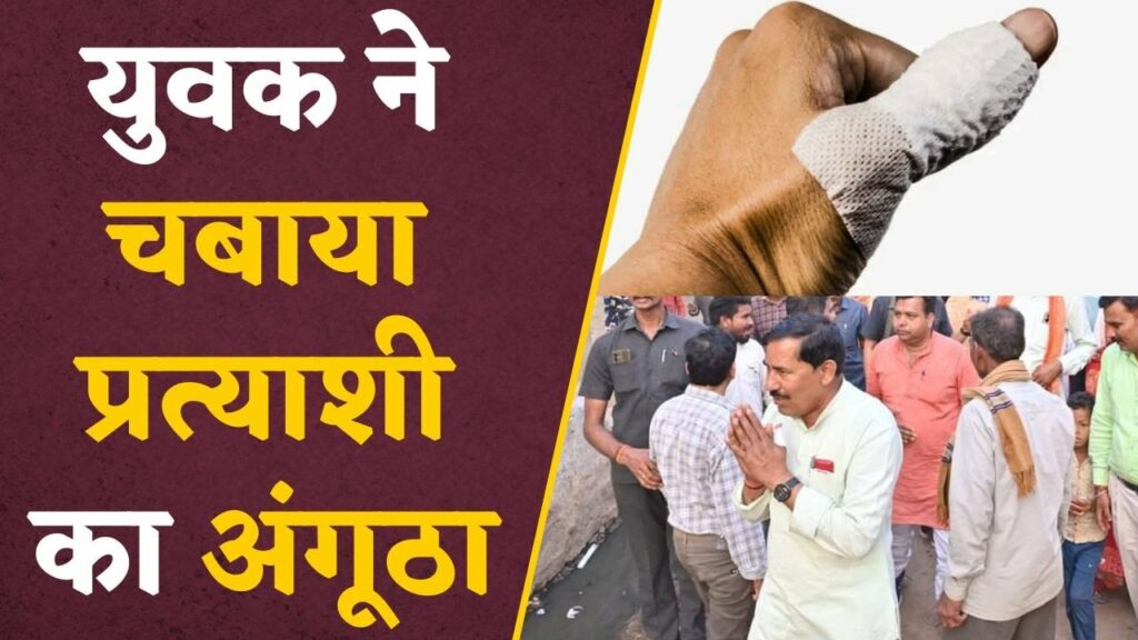 The leader did public relations by tying the thumb of BJP candidate and bandaged it.