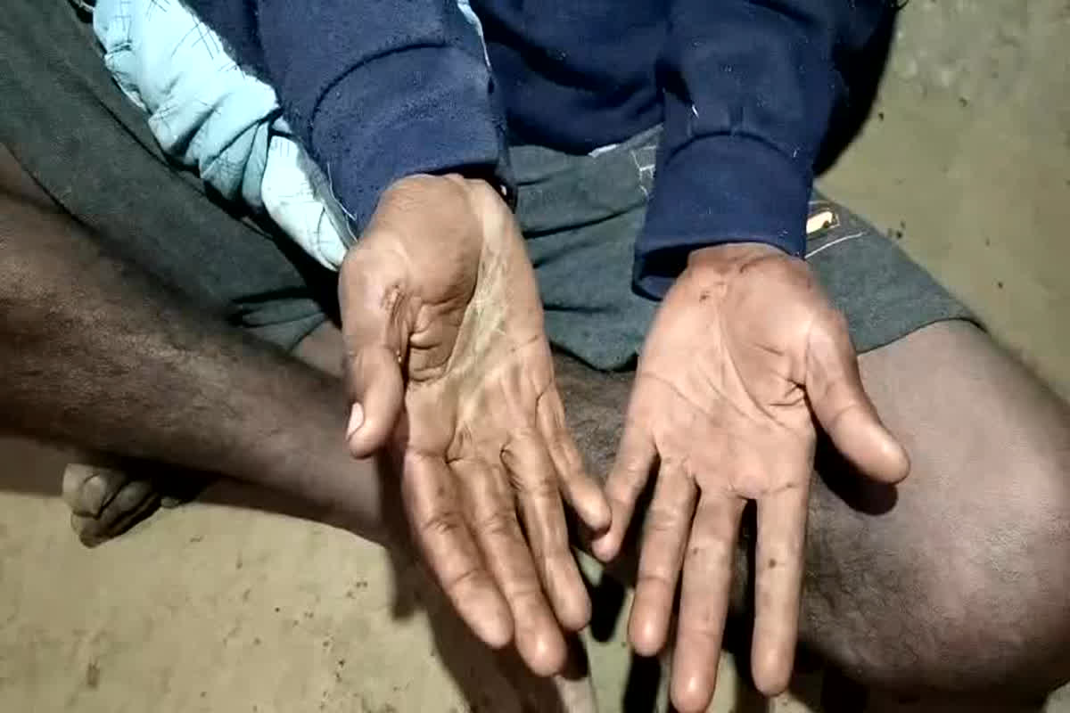 Dever Bhabhi News: भाभी पर अवैध संबंध का शक, देवर ने गले में कुल्हाड़ी से वारकर की हत्या, गिरफ्तार