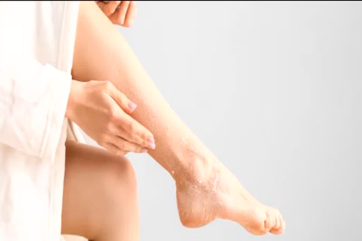 Skin Care Dead Skin: पैरों पर हो रही है ड्राई और डेड स्किन, तो खुद घर में ही ट्राई करें ये घरेलू नुस्खे…