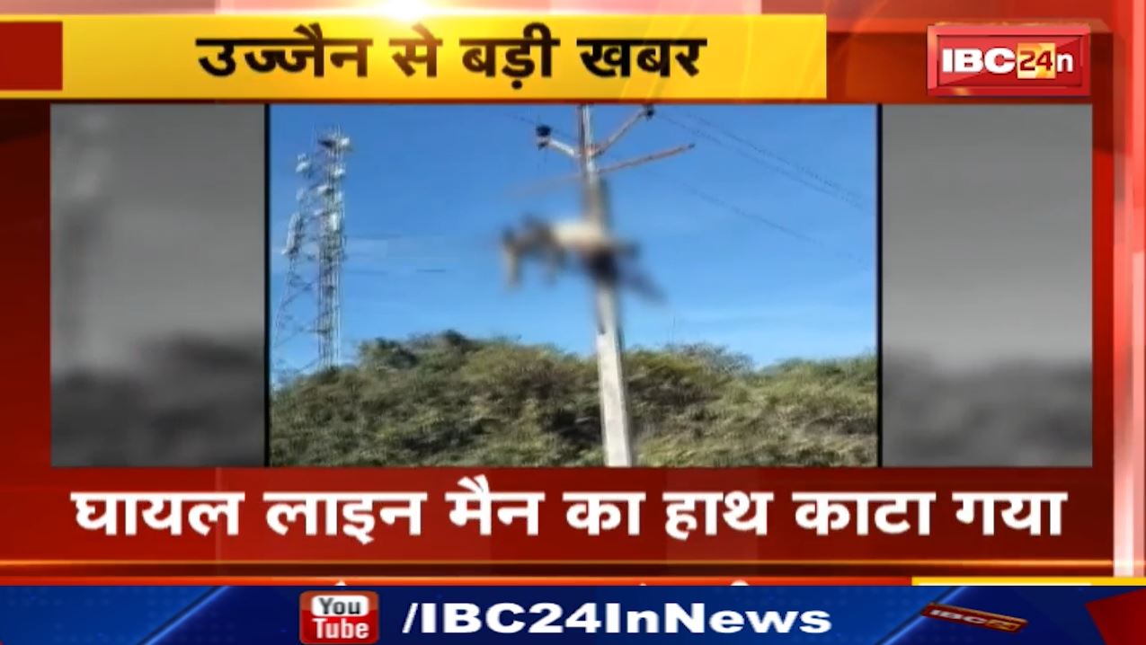 Ujjain News : करंट की चपेट में आया कर्मचारी | घायल लाइन मैन का हाथ काटा गया