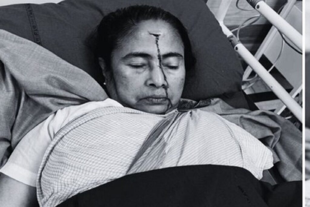 Mamata Banerjee Injury