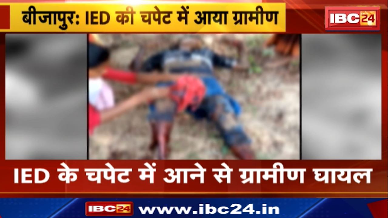 IED Blast in Bijapur : बीजापुर में प्रेशर IED की चपेट में आने से ग्रामीण गंभीर रूप घायल | नक्सलियों ने लगाया था