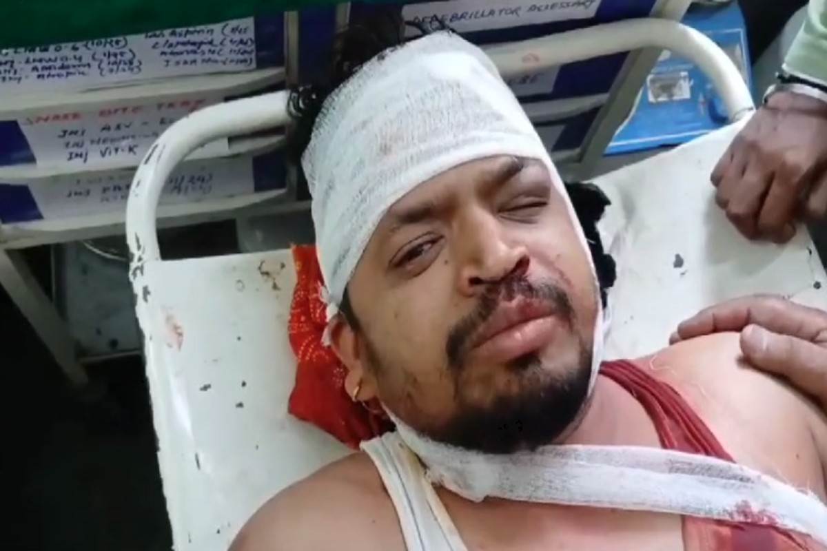 Professor Ki Pitai : आंखों में मिर्च पाउडर डालकर प्रोफेसर की बेरहमी से पीटा, फरार हुए सभी आरोपी, लहूलुहान अवस्था में पहुंचाया अस्पताल