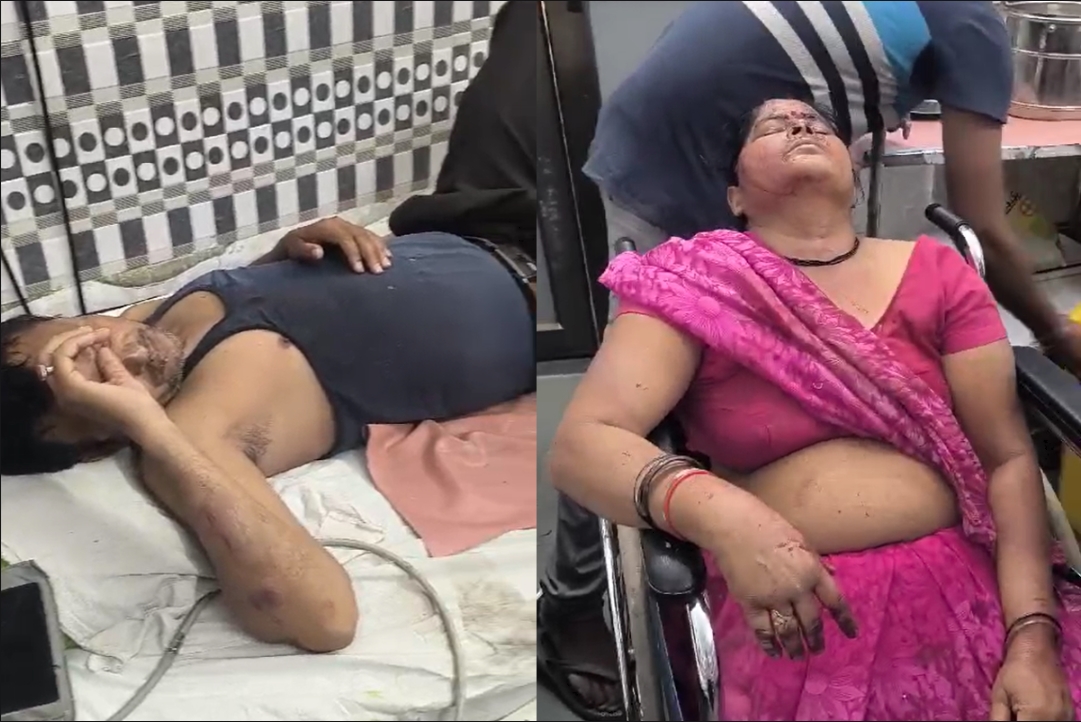 Jablapur Vivad News : दो पक्षों में विवाद..! कुल्हाड़ी और डंडों से परिवार पर किया वार, लहूलुहान हालत में पहुंचे अस्पताल