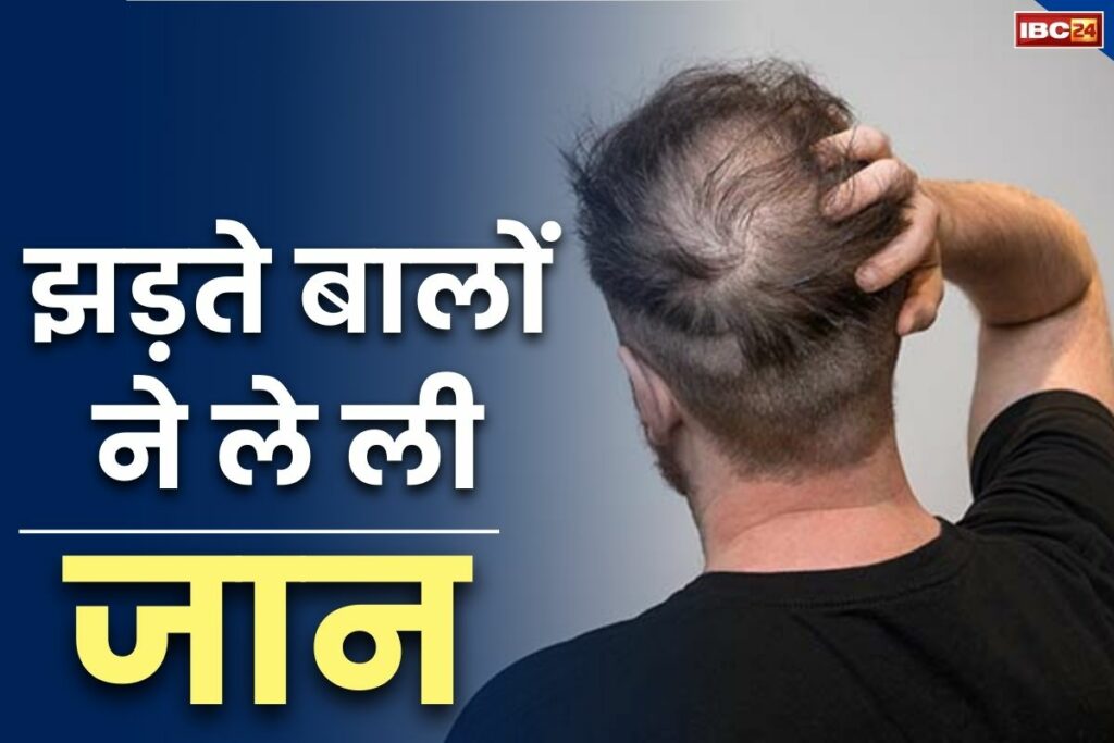 Suicide due to Hair loss | A young man committed suicide due to hair loss problem