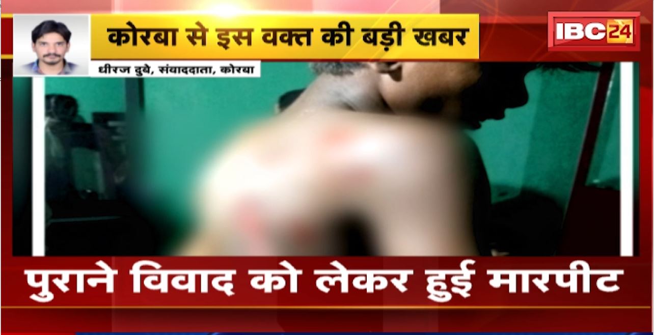 Korba Crime News : ताजिया रैली के दौरान आपस में भिड़े दो गुट। नाबालिग को आग की भट्ठी में झोंका