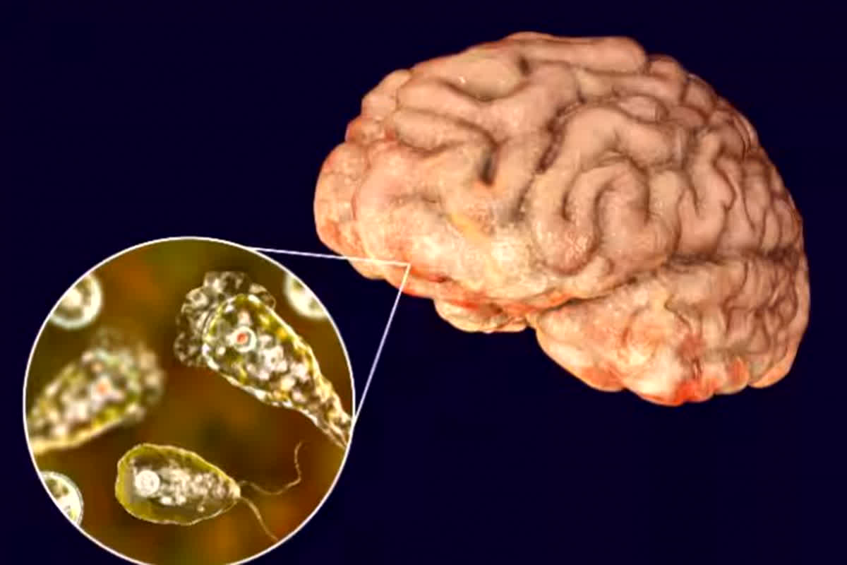 Brain-Eating Amoeba: दिमाग खाने वाले अमीबा ने ली एक और मासूम की जान, 2 महीने के अंदर 3 बच्चों की मौत…