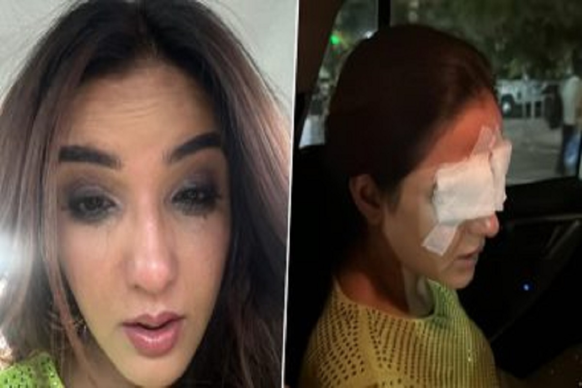 Jasmin Bhasin suffers corneal damage: इस परेशानी से गुजर रही जैस्मिन भसीन, आंखों पर पट्टी बांधे आई नजर