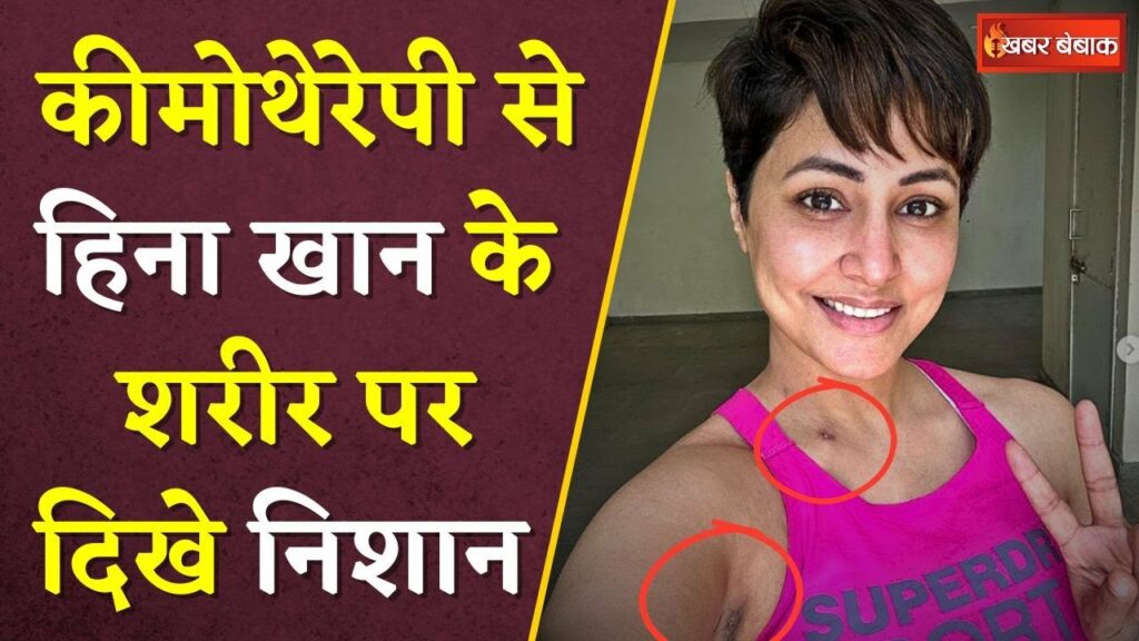 Bigg Boss actress Hina Khan becomes victim of breast cancer, shares her treatment experience