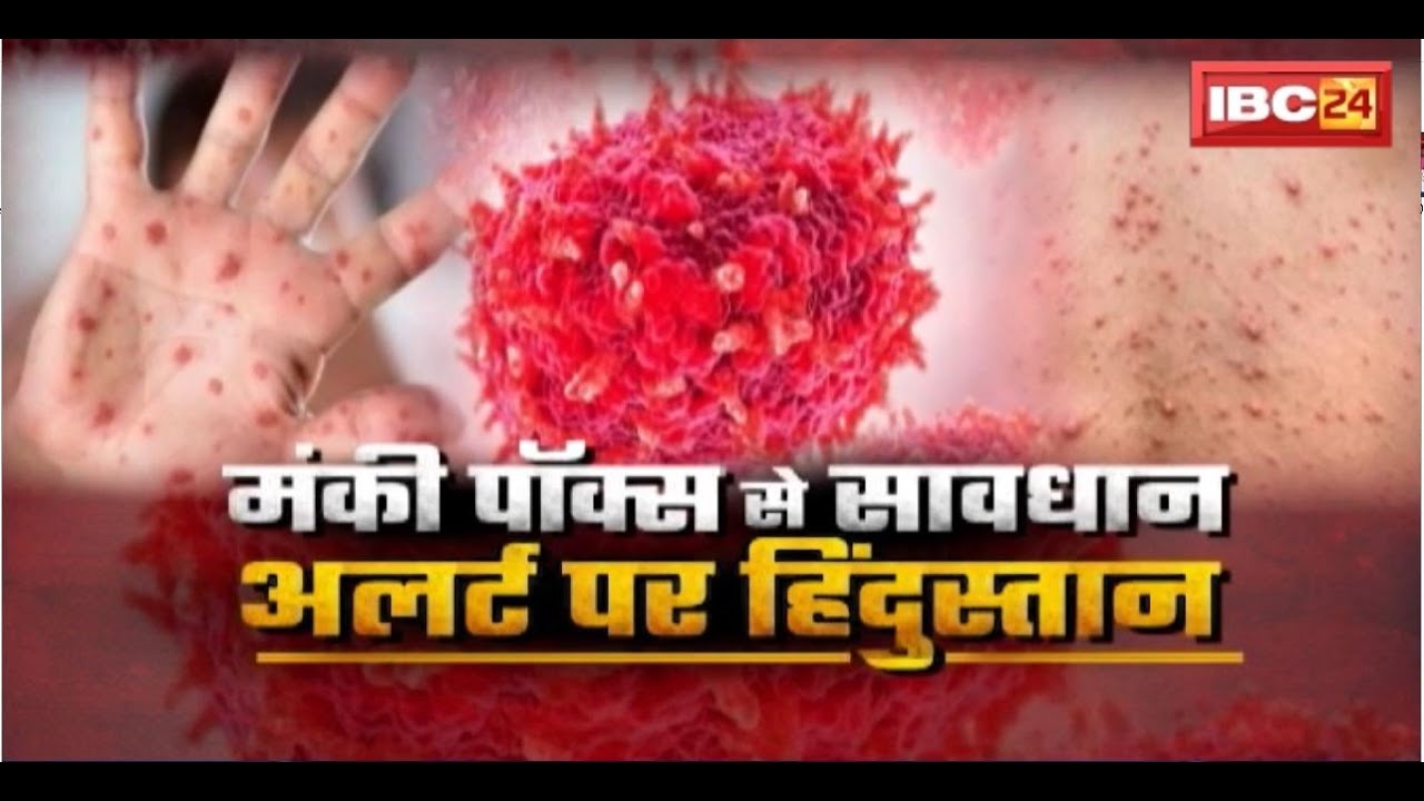 Monkey Pox Virus : मंकी पॉक्स से सावधान..अलर्ट पर हिंदुस्तान। सभी पोर्ट और एयरपोर्ट पर अलर्ट जारी