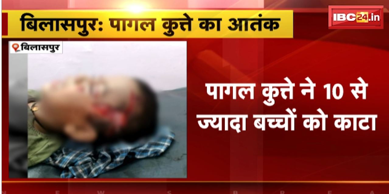 Bilaspur News : पागल कुत्ते ने 10 से ज्यादा बच्चों को काटा | घायल बच्चों को अस्पताल में किया गया भर्ती