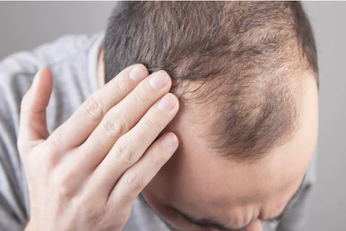Hair fall treatment: बाल झड़ना और नए बाल पाना: दवाओं से लेकर सर्जरी तक हैं विभिन्न उपाय..यहां देखें