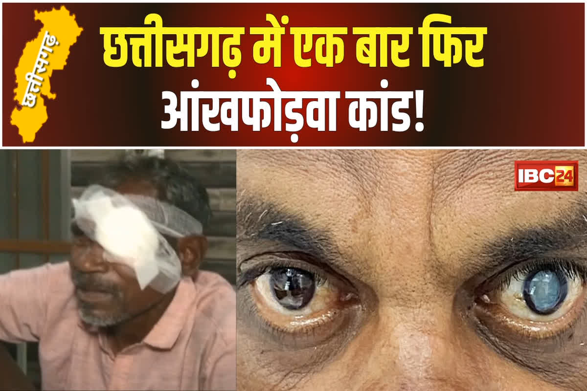 Dantewada Eye Surgery Case News: छत्तीसगढ़ में एक और अंखफोड़वा कांड? मोतियाबिंद के ऑपरेशन के बाद आंखों से आने लगा मवाद, 10 मरीजों की जिंदगी में हमेशा के लिए छा जाएगा अंधेरा!