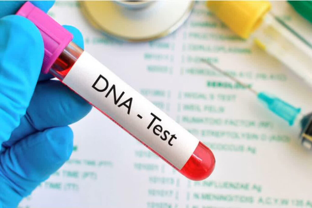 father requested for DNA test of his sons