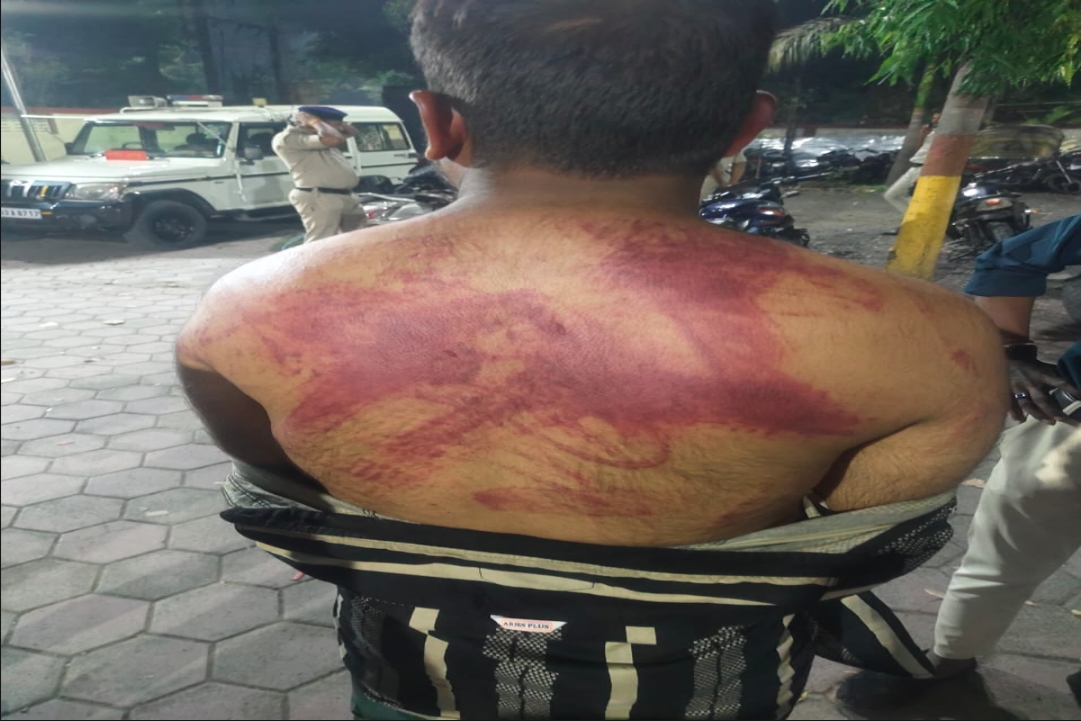 मुस्लिम युवती को मंदिर ले जाना पड़ा भारी.. लड़की के भाईयों ने युवक को जमकर पीटा, दी जान से मारने की धमकी