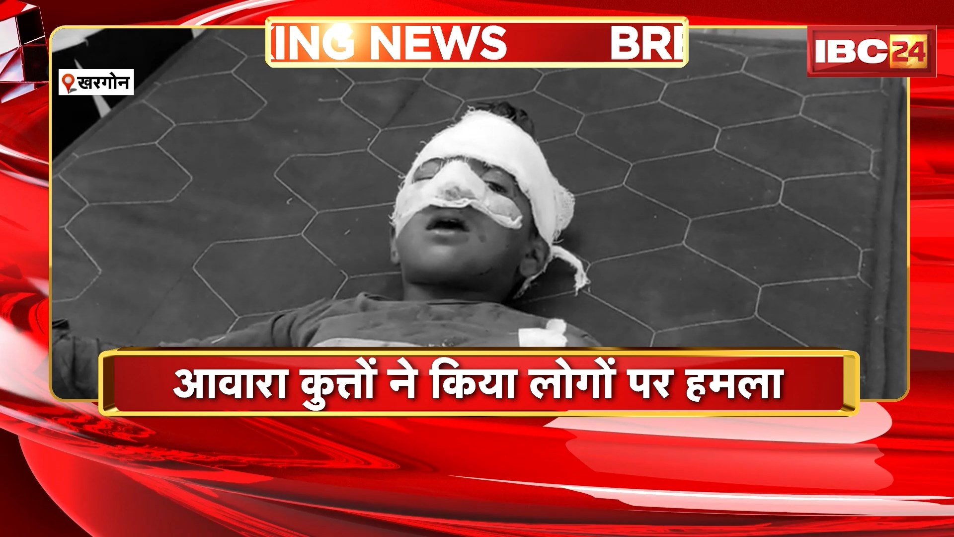 Khargone Dog Bite News: आवारा कुत्तों ने किया लोगों पर हमला। हमले में 12 लोग घायल, घायलों में 8 बच्चे भी शामिल..