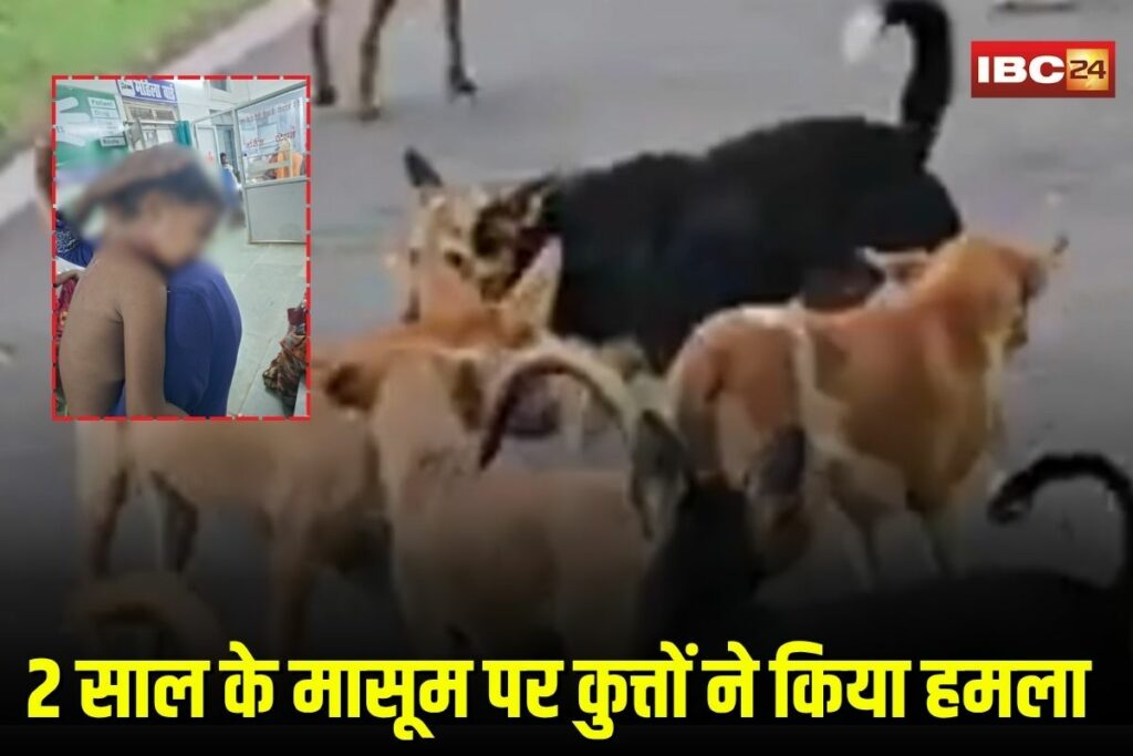 Dog Attack on Child | Image Source | IBC24