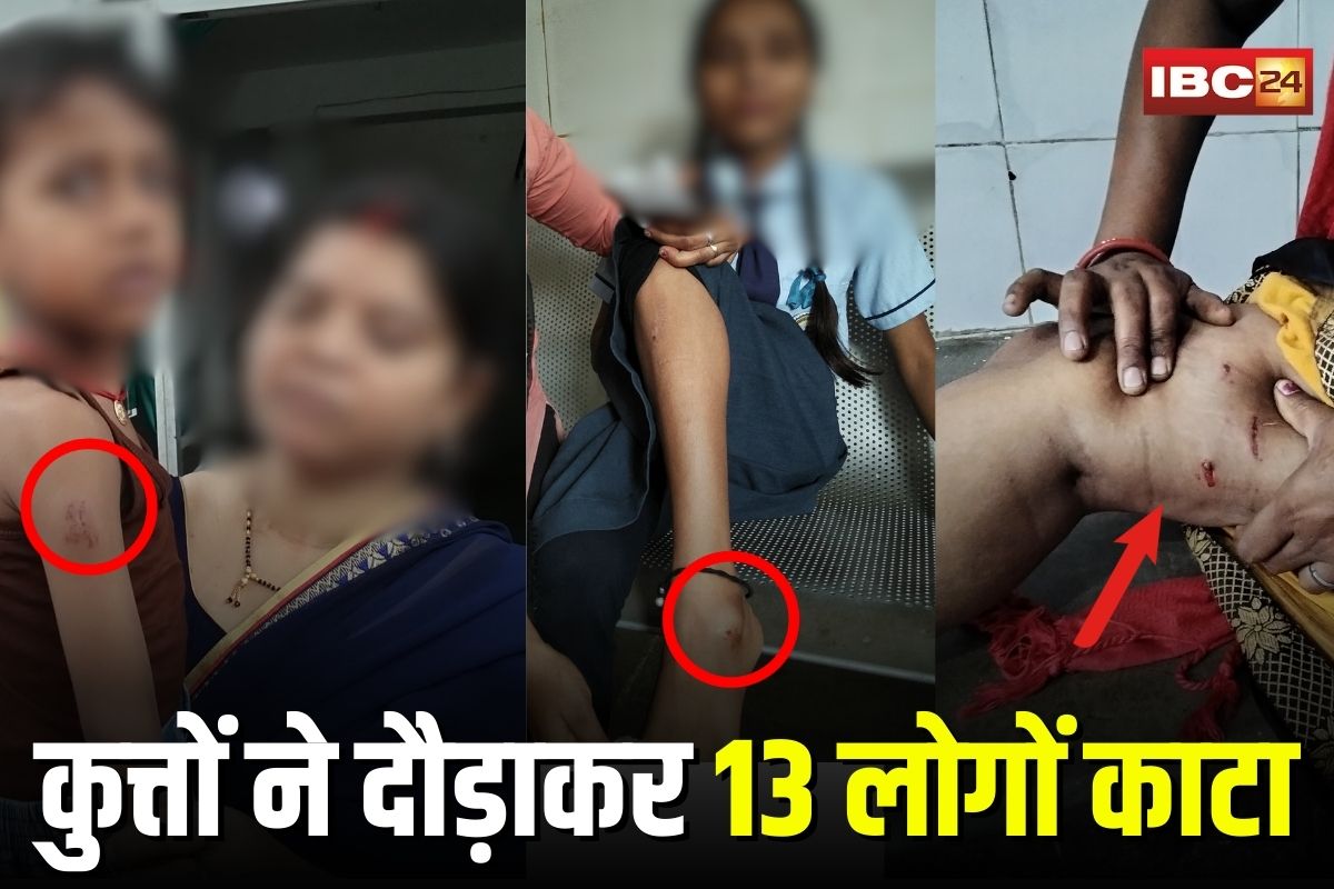 Dog Bite News: सड़क पर दौड़ाकर 13 लोगों काटा, बच्चों तक को नहीं छोड़ा, शहर में ऐसे मचाया आवारा कुत्तों ने आतंक