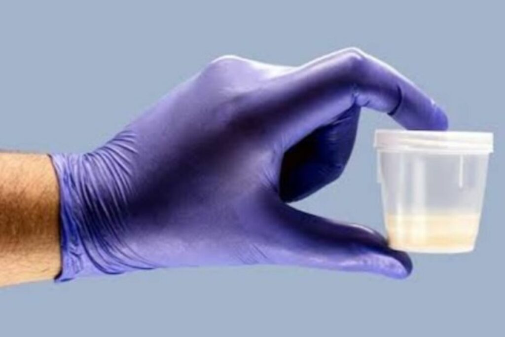 Sperm Smuggling: पुरुषों के वीर्य की तस्करी करती थी ये महिला डॉक्टर, मां बनने के बाद कपल ने कराया डीएनए टेस्ट / Image Source: Symbolic