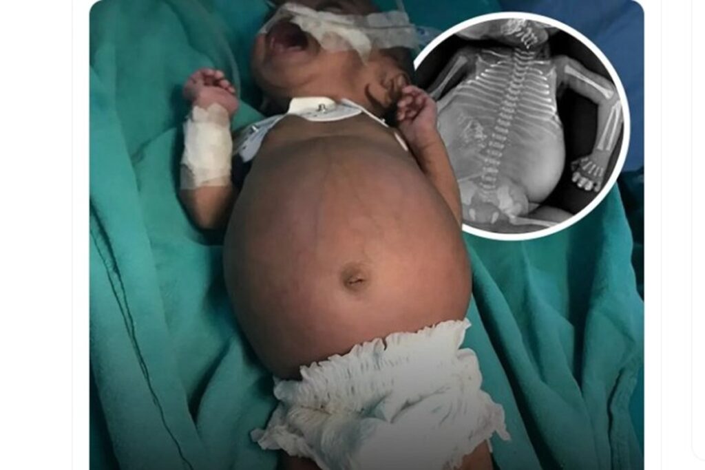 A baby was born already pregnant, image source: Ghar Ke Kalesh