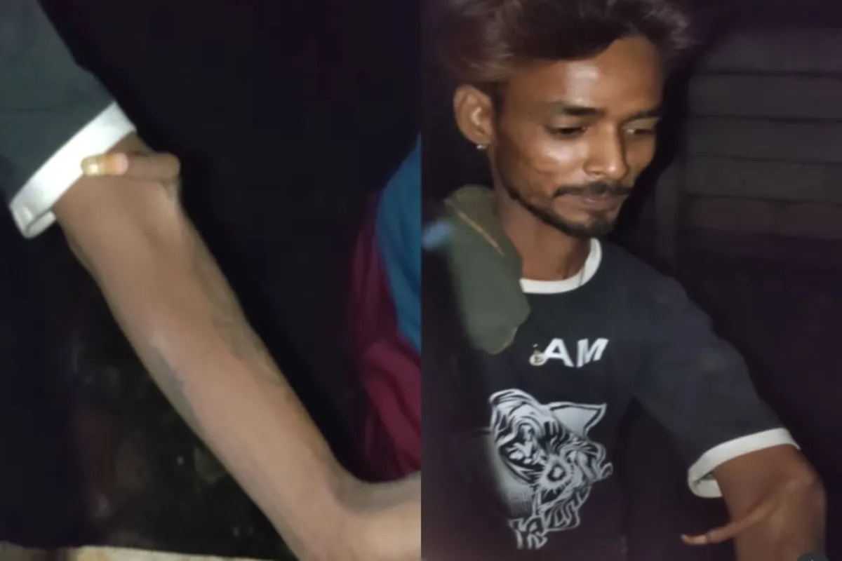 Elbow finger video: कोहनी पर निकली उंगली का वीडियो हुआ वायरल, लोग बोले – “ये क्या बला है?”