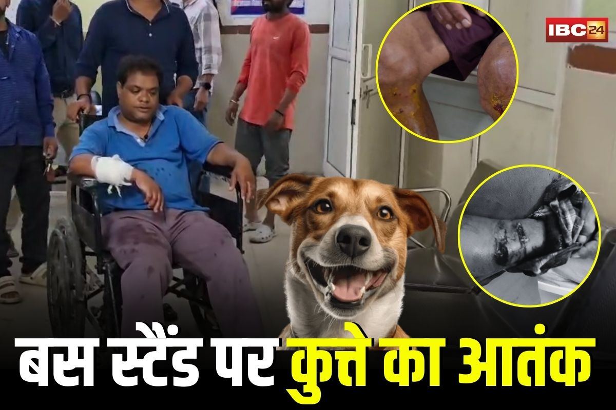 Narmadapuram News: शहर में आवारा कुत्ते का आतंक! बस स्टैंड पर एक दर्जन से ज्यादा लोगों को काटा, सभी अस्पताल में भर्ती, 3 की हालत गंभीर