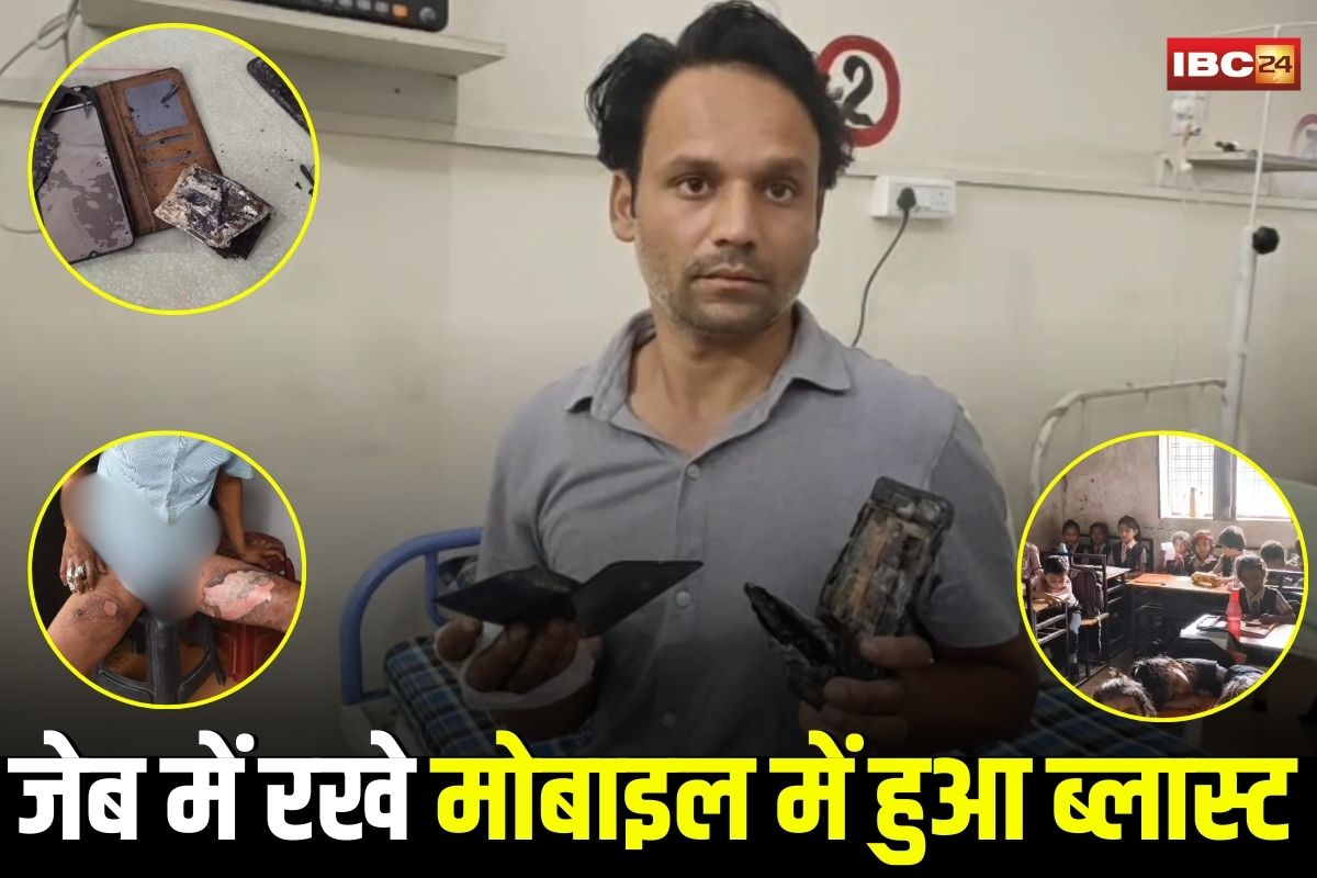 Shahdol News: शिक्षक के जेब में रखे मोबाइल में लगी आग, बाहर निकालते ही हुआ ब्लास्ट, टीचर के हाथ और जांघ जल गया