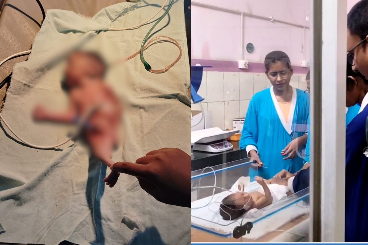 Dhamtari News: छत्तीसगढ़ में जन्मा ‘जलपरी’ जैसा शिशु, अद्भुत रूप देख दंग रह गए डॉक्टर, फिर जन्म के कुछ ही देर बाद कांप उठे लोग