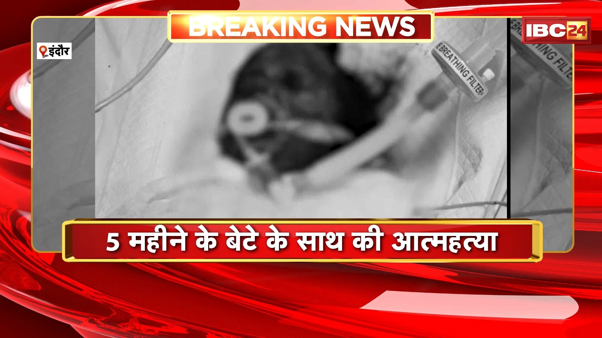 Indore Suicide Case:  5 माह के मासूम के साथ मां ने खुद पर डाला ज्वलनशील पदार्थ। पति पर लगाया प्रताड़ना का आरोप