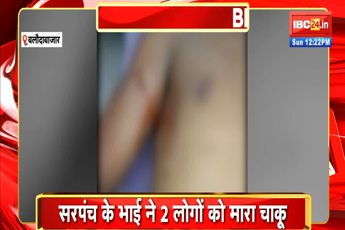 Baloda Bazar Chakubaji News: बलौदाबाजार में एक और चाकूबाजी, सरपंच के भाई ने दो युवकों पर किया हमला, गंभीर हालत में इलाज जारी