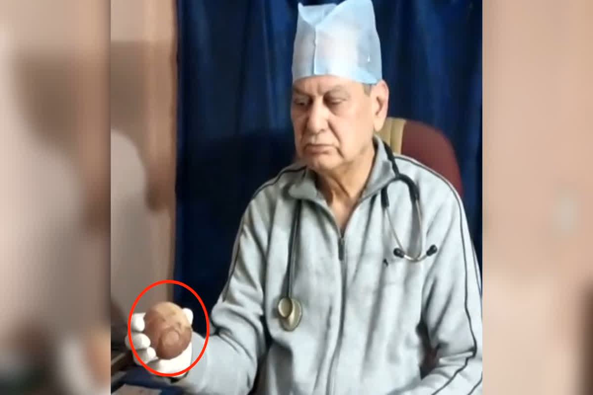 Panna News: इलाज के दौरान युवक के पेट से निकला ऐसा चीज, देखकर खुद डॉक्टर रह गए हैरान, वीडियो देखकर आपको भी नहीं होगा यकीन