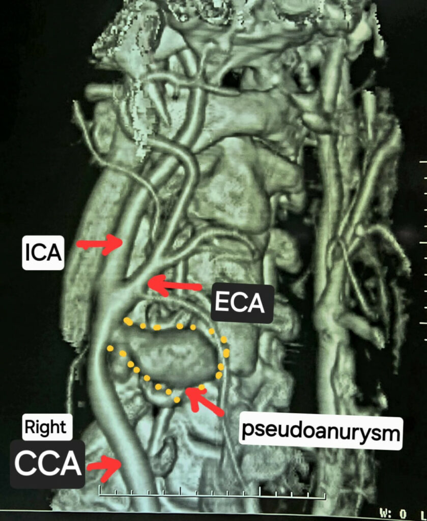 Image Credit: CG DPR 