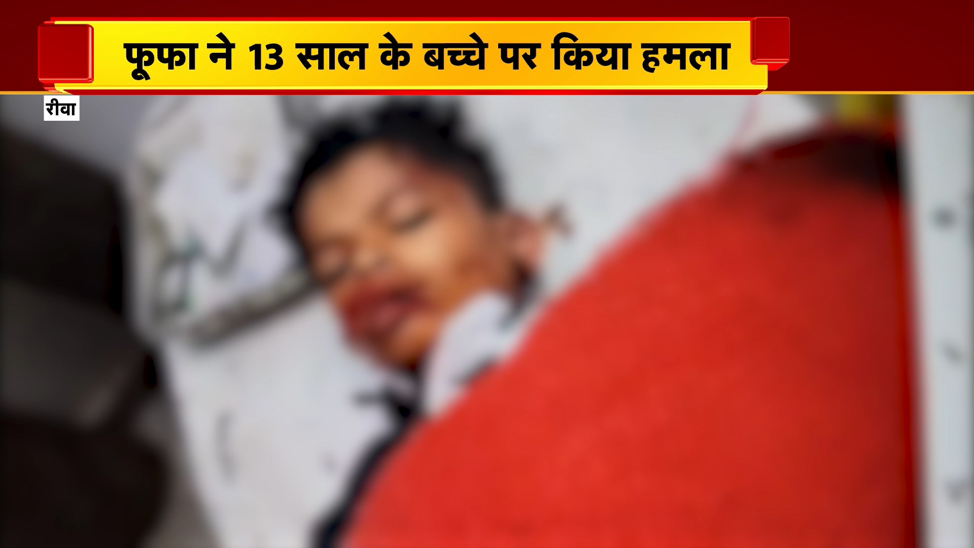 Rewa News : फूफा ने 13 साल के बच्चे पर किया हमला | गोविंदगढ़ थाना क्षेत्र की घटना