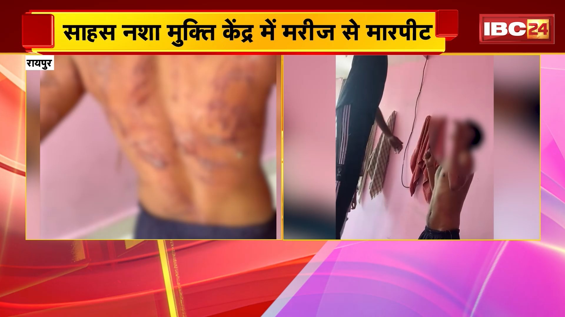 Raipur Crime News: साहस नशा मुक्ति केंद्र में मरीज से मारपीट, पीड़ित युवक के परिजन ने कराई FIR