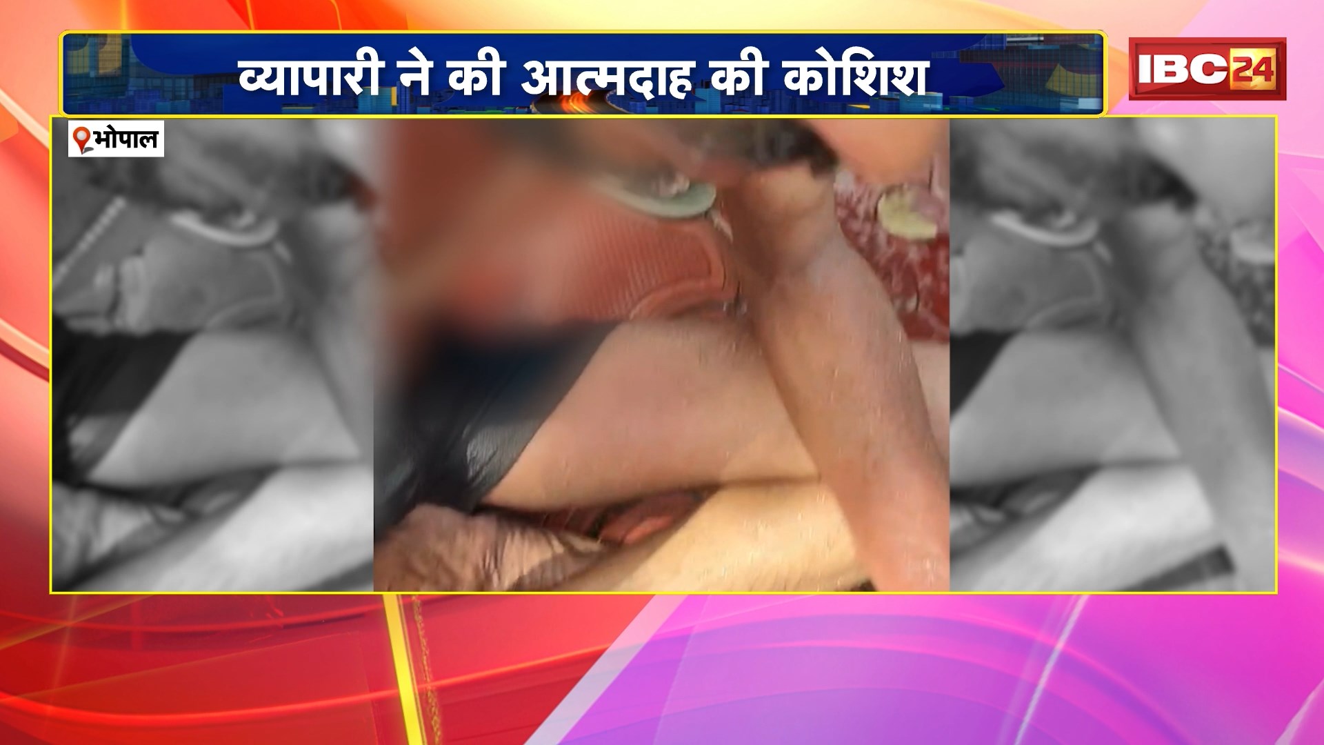 Bhopal Suicide News: 10 नंबर मार्केट में अतिक्रमण हटाने पहुंची थी टीम, व्यापारी ने की आत्मदाह की कोशिश