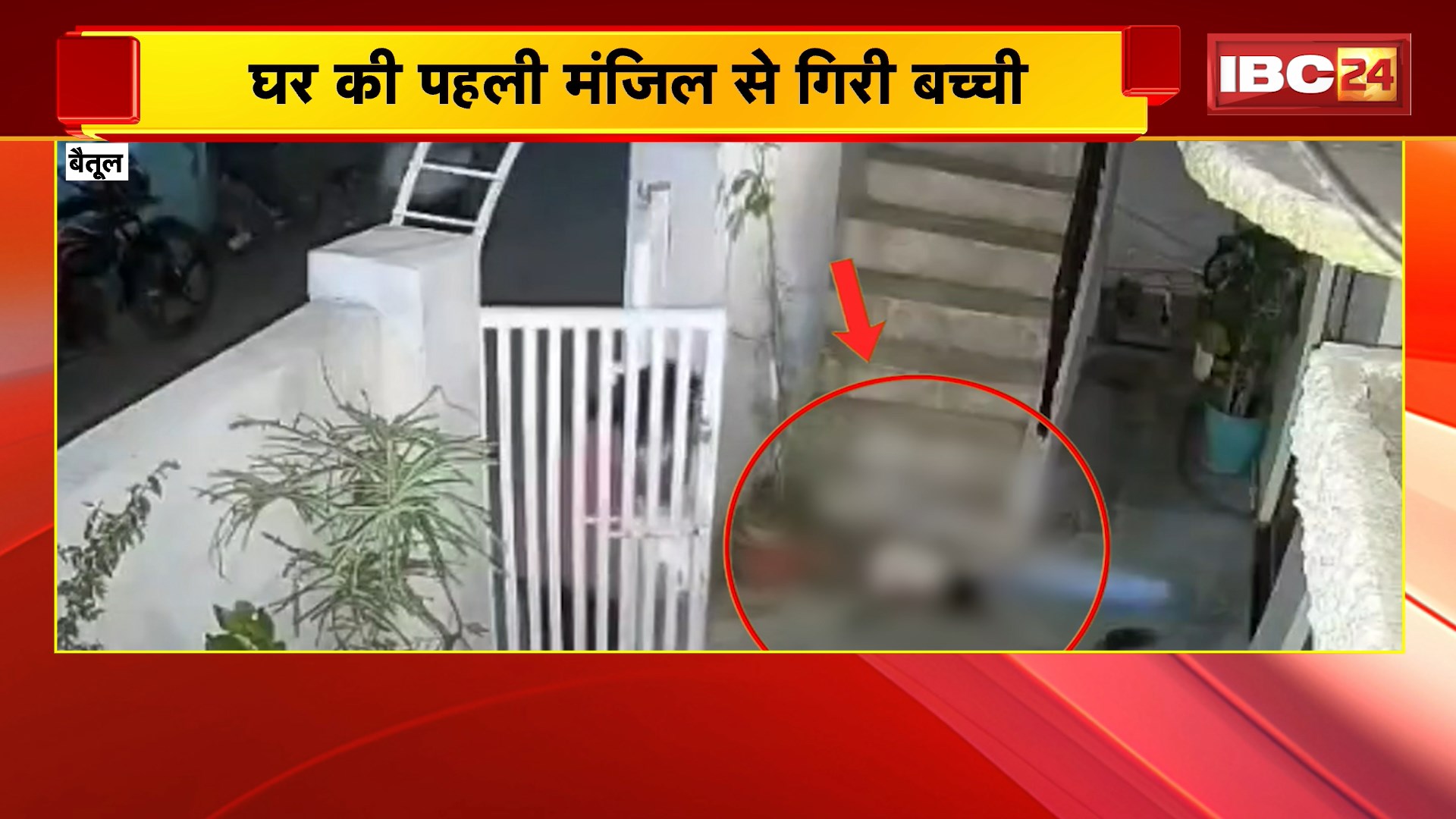 Betul Accident : घर की पहली मंजिल से गिरी बच्ची। हादसे में गंभीर रुप से घायल हुई मासूम