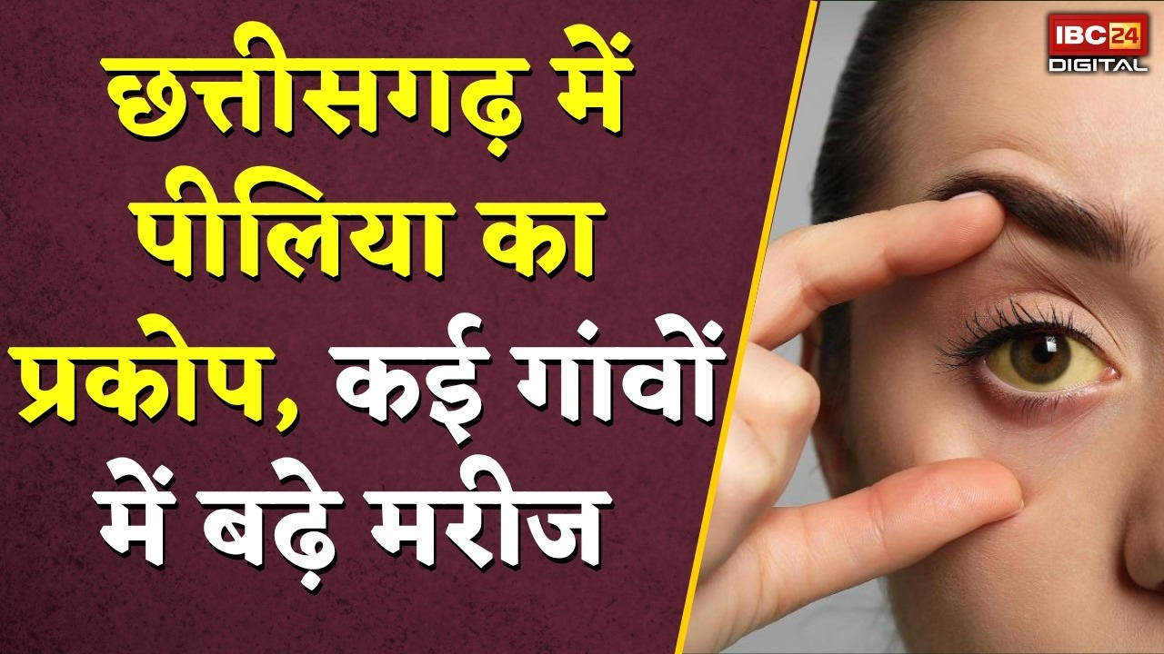 Jaundice in Chhattisgarh: Chhattisgarh में पीलिया का प्रकोप, कई गांवों में बढ़े मरीज |