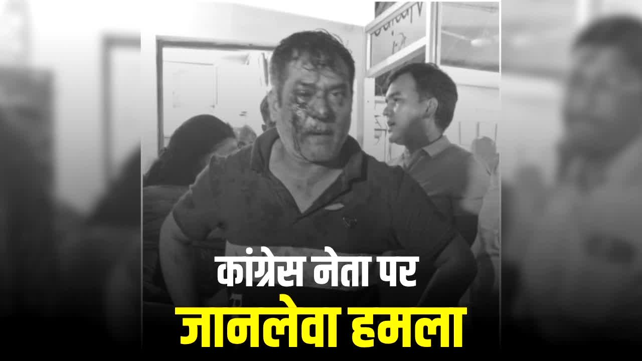 Chhattisgarh Congress Leader Attack: छत्तीसगढ़ में कांग्रेस नेता पर जानलेवा हमला, इस BJP नेता पर हमला करवाने का आरोप, 15 से ज्यादा बदमाश घर में घुसे फिर….पत्नी को भी नहीं छोड़ा