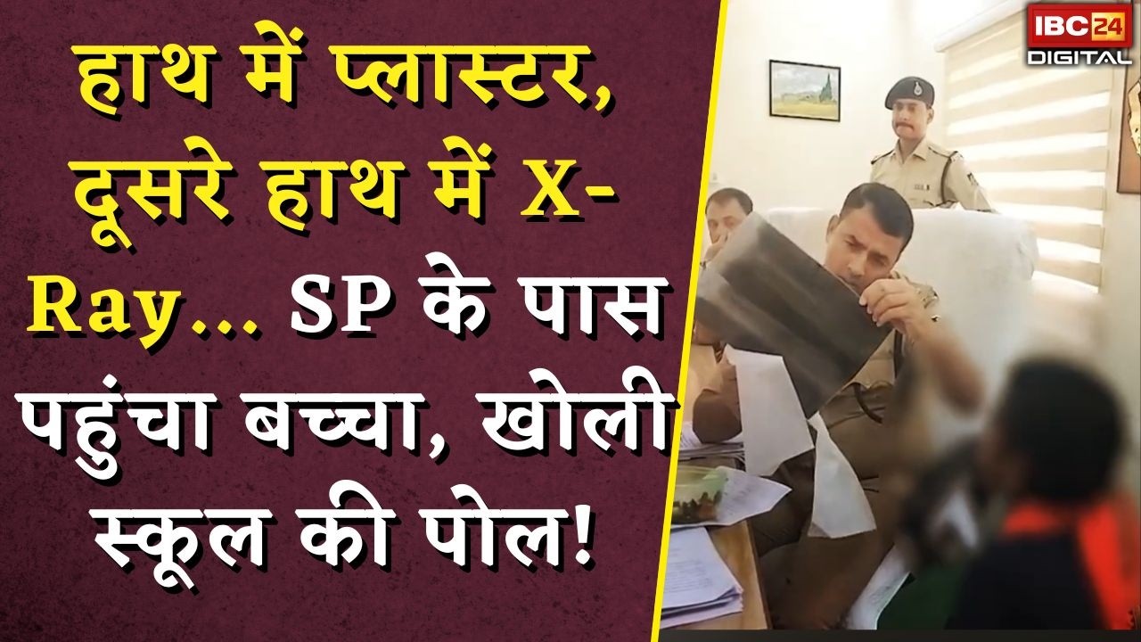 Morena News: हाथ में प्लास्टर, दूसरे हाथ में X-Ray… SP के पास पहुंचा बच्चा, खोली स्कूल की पोल!