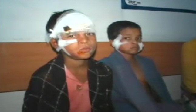 जंगली सुअर के हमले से 4 बच्चे घायल