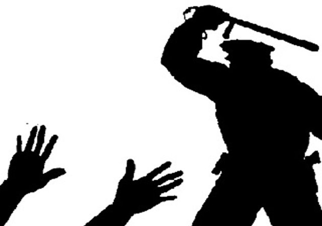 शहडोल: युवक ने पुलिस पर लगाया बेरहमी से पीटने का आरोप