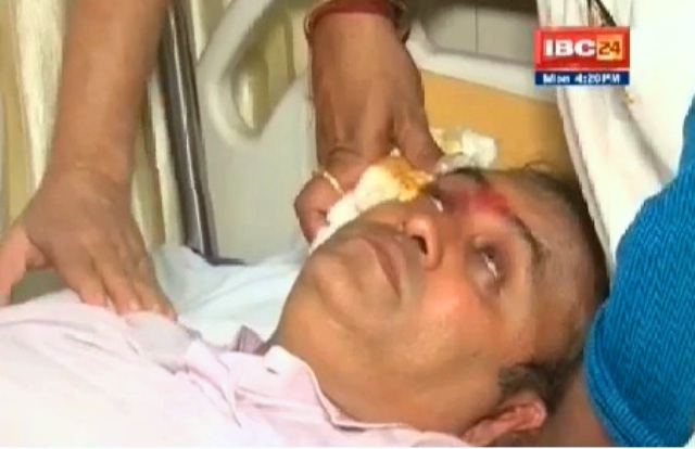 भोपाल: CM हाउस का घेराव करने पहुंचे NSUI कार्यकर्ताओं पर पुलिस ने जमकर भांजी लाठी, अरुण यादव घायल