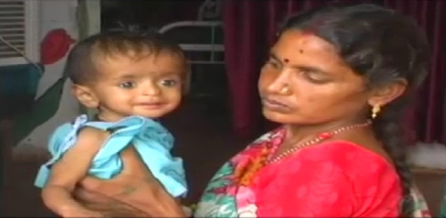 पन्ना में लगातार बढ़ रहे कुपोषण के मामले, सरकार सुस्त