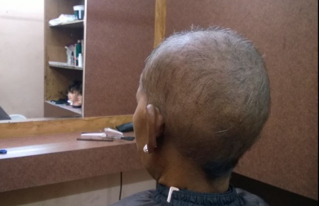 कैंसर मरीजों के बाल प्रत्यारोपण की अनोखी पहल