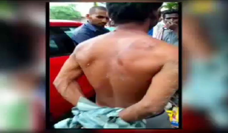 चोरी के शक में भीड़ ने कर दी युवक की पिटाई 