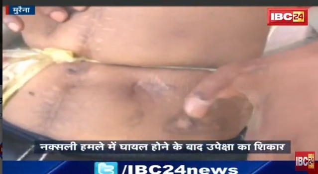 नक्सली हमले में 7 गोलियां खाने के बाद जवानों के साथ ऐसा सुलूक शर्मनाक, ये है सरकार की सच्चाई