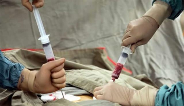 प्रदेश में पहली बार शासकीय अस्पताल में बोन मैरो का सफल ट्रांसप्लांट