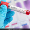 Swine flu in chhattisgarh: इस जिले में स्वाइन फ्लू ने दी दस्तक, स्वास्थ विभाग में मचा हड़कंप